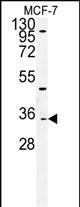 WB - TTPAL Antibody (C-term) AP5164b
