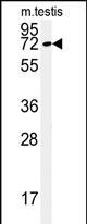 Western blot analysis of KLHL9 Antibody (Center) (Cat. #AP5173c) in mouse testis tissue lysates (35ug/lane).KLHL9 (arrow) was detected using the purified Pab.