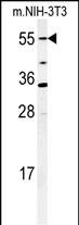 Western blot analysis of CYP26A1 Antibody (C-term) (Cat. #AP2754d) in mouse NIH-3T3 cell lysates (35ug/lane).CYP26A1 (arrow) was detected using the purified Pab.