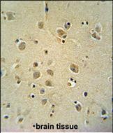 IHC-P - ZIC3 Antibody (Center) AP2761c