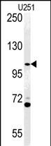 Western blot analysis of ACAP3 Antibody  (N-term) (Cat. #AP5177a) in U251 cell line lysates (35ug/lane).ACAP3 (arrow) was detected using the purified Pab.