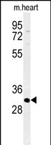WB - ATP4B Antibody (N-term) AP5181a