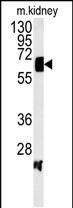 Western blot analysis of ATP6V1H Antibody (C-term) (Cat. #AP5182b) in mouse kidney tissue lysates (35ug/lane).ATP6V1H (arrow) was detected using the purified Pab.