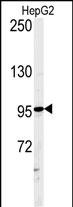 WB - ATXN2L Antibody (C-term) AP5183b