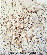 IHC-P - HAUS5 Antibody (N-term) AP5230a