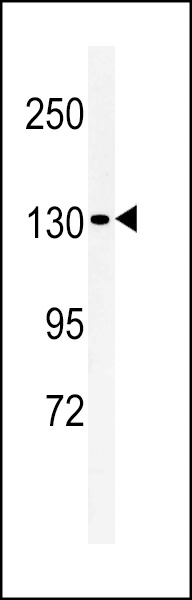 WB - L1TD1 Antibody (C-term) AP5240b