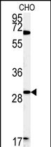 WB - LHPL2 Antibody (C-term) AP5242b