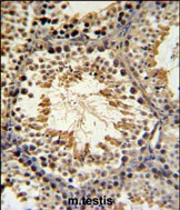 IHC-P - SPG16 Antibody (Center) AP5274c