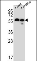 WB - TMEM87B Antibody (C-term) AP5285b