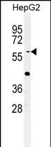 WB - YLAT2 Antibody  (C-term) AP5300b