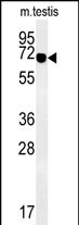 WB - ZBTB5 Antibody  (N-term) AP5302a