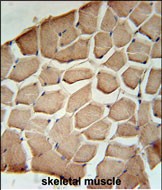 IHC-P - NPAL3 Antibody (N-term) AP5321a