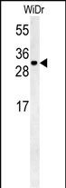 WB - TM2D3 Antibody (N-term) AP5366a