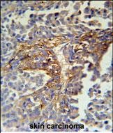 IHC-P - ARMC5 Antibody (C-term) AP5400b