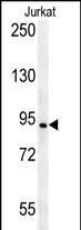 AXIN2 Antibody (C-term)(Cat. #AP5416b) western blot analysis in Jurkat cell line lysates (35ug/lane).This demonstrates the AXIN2 antibody detected the AXIN2 protein (arrow).