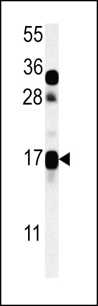WB - CSAG2 Antibody (N-term) AP5424a