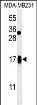 WB - SMIM14 Antibody (C-term) AP5437b