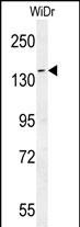 DAAM1-T361 Antibody (N-term) (Cat.#AP5439a) western blot analysis in WiDr cell line lysates (35ug/lane).This demonstrates the DAAM1 antibody detected the DAAM1 protein (arrow).