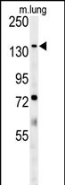 ATP11C Antibody (Center) (Cat.#AP5446c) western blot analysis in mouse lung tissue lysates (35ug/lane).This demonstrates the ATP11C antibody detected ATP11C protein (arrow).