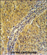 IHC-P - DYNC1LI2 Antibody (Center) AP5478c