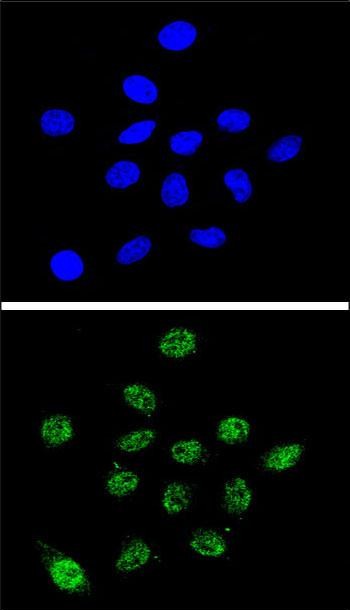 Confocal immunofluorescent analysis of DKC1 Antibody (Center)(Cat. #AP5479c) with 293 cell followed by Alexa Fluor� 488-conjugated goat anti-rabbit lgG (green). DAPI was used to stain the cell nuclear (blue).