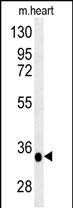 WB - PRB2 Antibody (C-term) AP5480b