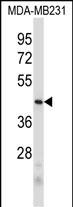 WB - PRB2 Antibody (C-term) AP5480b