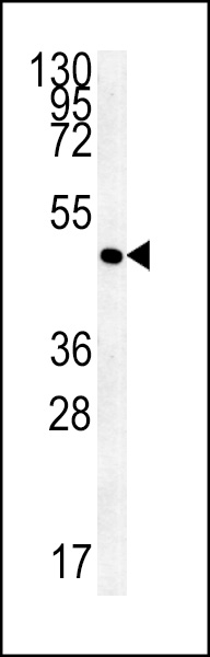 WB - FLJ11506 Antibody (C-term) AP5483b