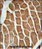 IHC-P - CTTB2 Antibody (N-term) AP5490a