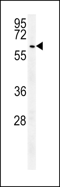 WB - USP17L24 Antibody (C-term) AP5491b