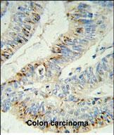 IHC-P - PHLPP2 Antibody (C-term) AP7799B