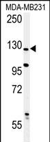WB - PHLPP2 Antibody (C-term) AP7799B