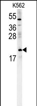 PMCH Antibody (Center) (Cat. #AP5528c) western blot analysis in K562 cell line lysates (15ug/lane).This demonstrates the PMCH antibody detected the PMCH protein (arrow).