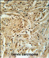 IHC-P - BLOC1S2 Antibody (Center) AP5538c
