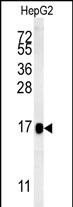 WB - BLOC1S2 Antibody (Center) AP5538c