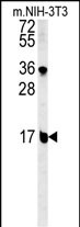 WB - BLOC1S2 Antibody (Center) AP5538c
