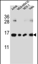 WB - H2AFJ Antibody (N-term) AP5572a