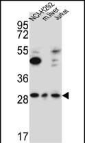 WB - TAF1D Antibody  (N-term) AP5597a