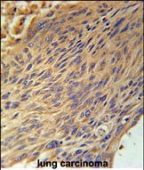 IHC-P - CPEB4 Antibody (N-term) AP5628a