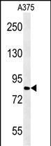 WB - CPEB4 Antibody (N-term) AP5628a