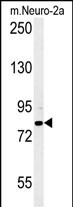 WB - CPEB4 Antibody (N-term) AP5628a