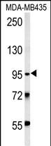 WB - TRHDE Antibody (C-term) AP5635b