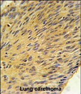 IHC-P - MURC Antibody (N-term) AP5646a
