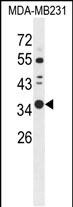 Western blot analysis of STX7 Antibody (N-term) (Cat. #AP5670a) in MDA-MB231 cell line lysates (35ug/lane).STX7 (arrow) was detected using the purified Pab.