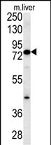 MCCC1 Antibody (Center) (Cat. #AP5676c) western blot analysis in mouse liver tissue lysates (15ug/lane).This demonstrates the MCCC1 antibody detected MCCC1 protein (arrow).