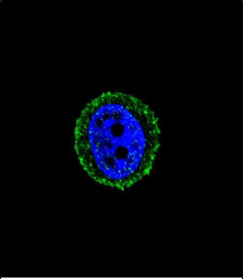 Confocal immunofluorescent analysis of CALCR Antibody (C-term)(Cat#AP5688b) with MCF-7 cell followed by Alexa Fluor� 488-conjugated goat anti-rabbit lgG (green). DAPI was used to stain the cell nuclear (blue).