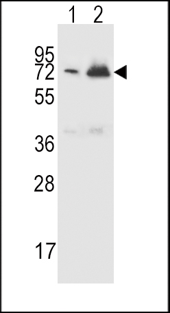 CFHR5 Antibody (Center) (Cat. #AP5689c) western blot analysis in CEM(lane 1),K562(lane 2) cell line lysates (15ug/lane).This demonstrates the CFHR5 antibody detected the CFHR5 protein (arrow).