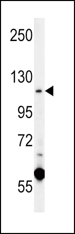 WB - CACNA2D4  Antibody (N-term) AP5708a