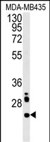 WB - LHPL3 Antibody  (C-term) AP5721b