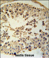 IHC-P - CCYL1 Antibody (N-term) AP5730a